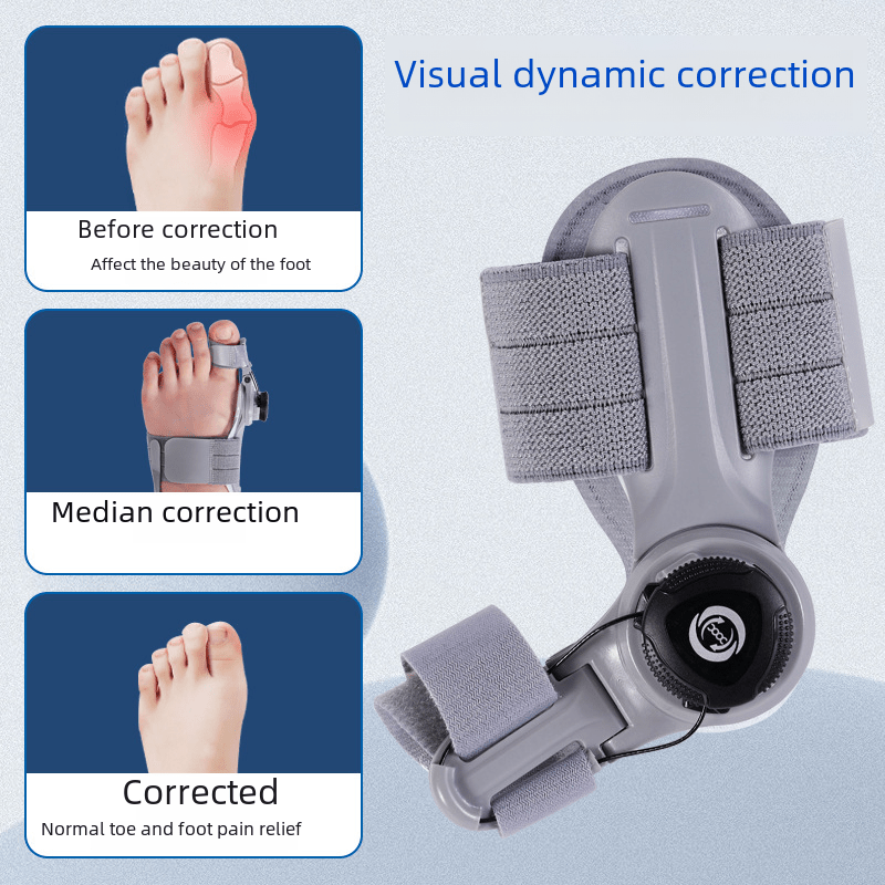 Upgraded Adjustable Bunion Corrector - NovaNexa